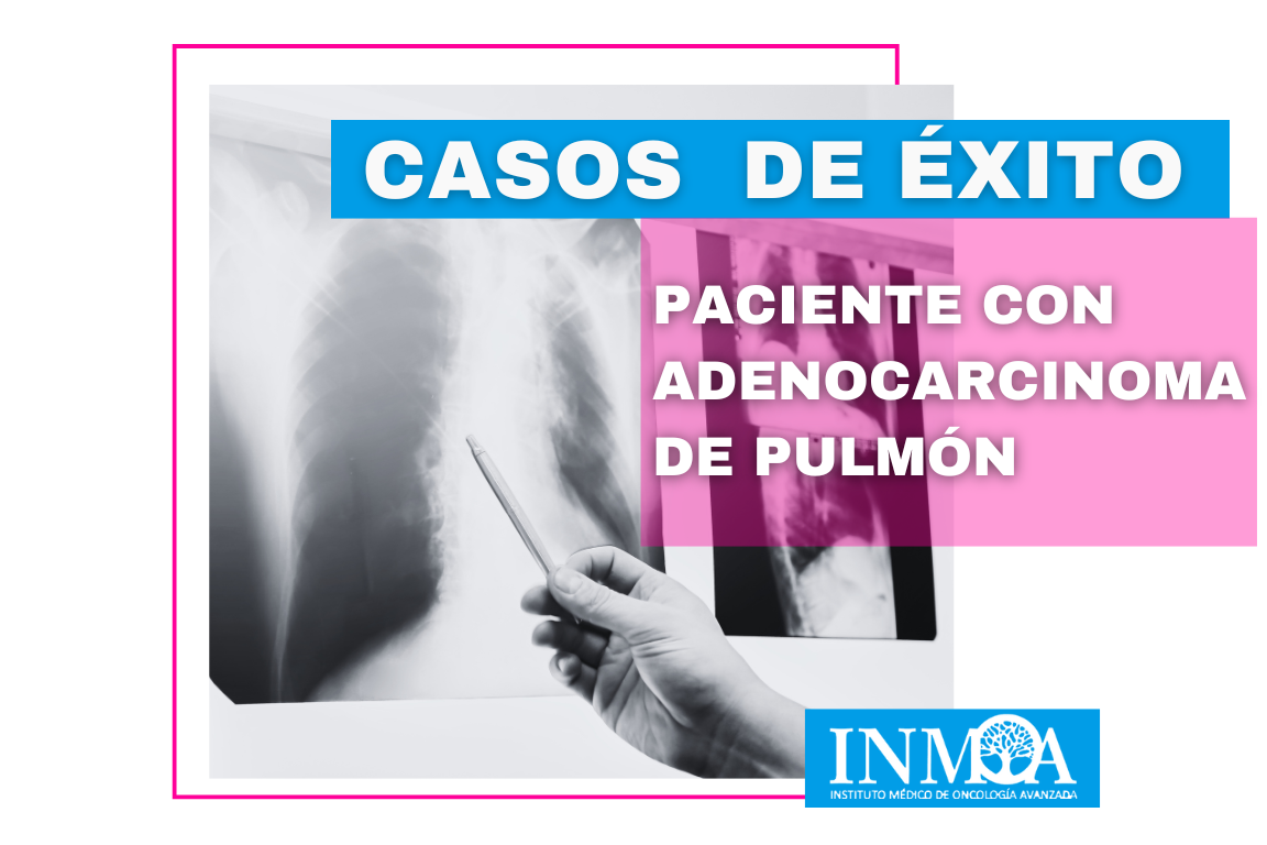 2025_02_27 Caso de éxito INMOA Adenocarcinoma de Pulmón_imagen destacada nuevo diseño_2