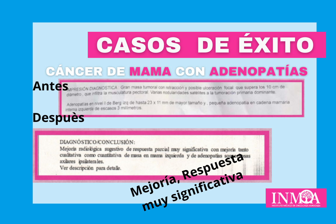 Caso de Éxito INMOA cáncer de mama con adenopatías_imagen destacada