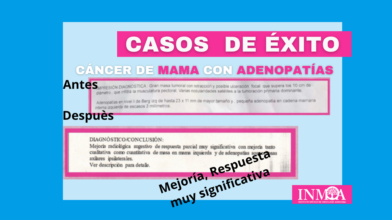Caso de Éxito INMOA cáncer de mama con adenopatías_imagen destacada