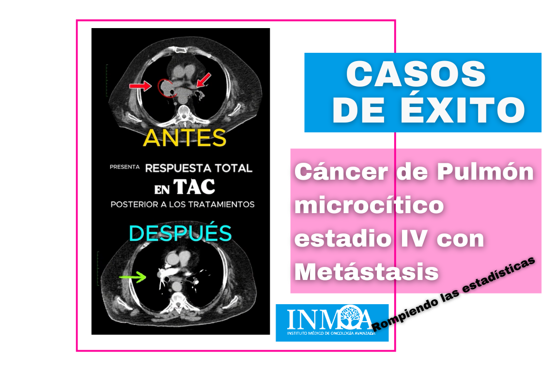 2025_03_06 Caso de éxito Oncothermia INMOA Cáncer de Pulmón Microcítico estadio IV Metástasis