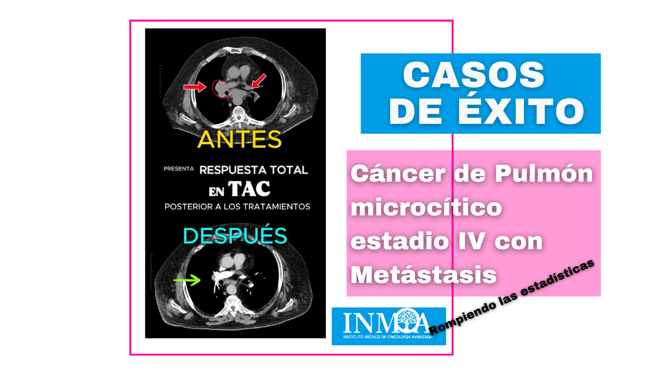 2025_03_06 Caso de éxito Oncothermia INMOA Cáncer de Pulmón Microcítico estadio IV Metástasis