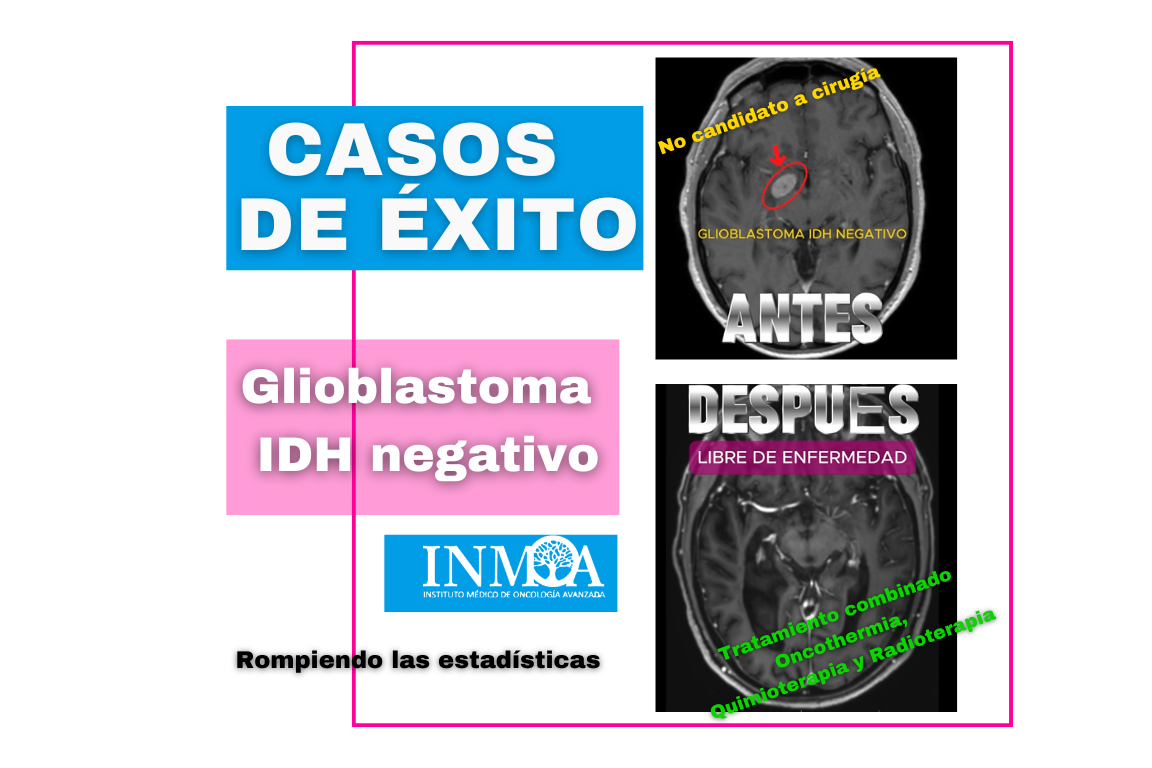 Caso de Exito INMOA Oncothermia Glioblastoma IDH negativo_imagen destacada