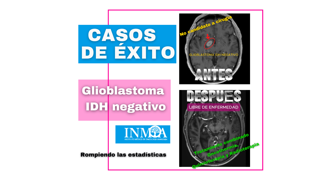 Caso de Exito INMOA Oncothermia Glioblastoma IDH negativo_imagen destacada