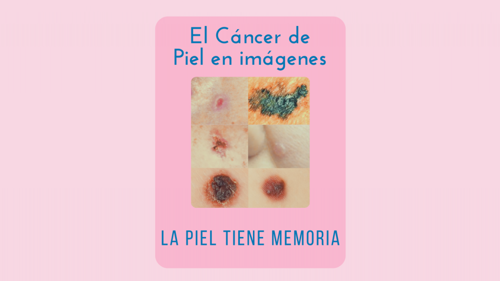 Cancer de piel fotos Ponencia Oncologa Dra. Arrojo INMOA_imagen destacada