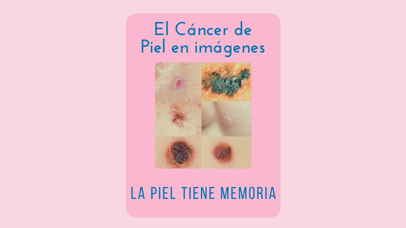 Cancer de piel fotos Ponencia Oncologa Dra. Arrojo INMOA_imagen destacada