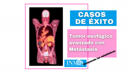 INMOA CASO DE ÉXITO REAL - Tumor esofágico avanzado con metástasis_imagen destacada
