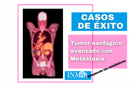 INMOA CASO DE ÉXITO REAL - Tumor esofágico avanzado con metástasis_imagen destacada