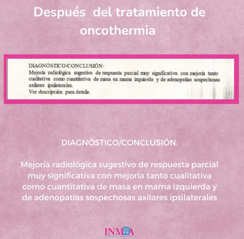 2024_10_17 Caso de exito Oncothermia INMOA Cáncer de mama con adenopatias_3
