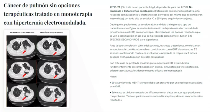 Caso de éxito INMOA en Cáncer de Pulmón sin opciones terapéuticas_con texto web antigua